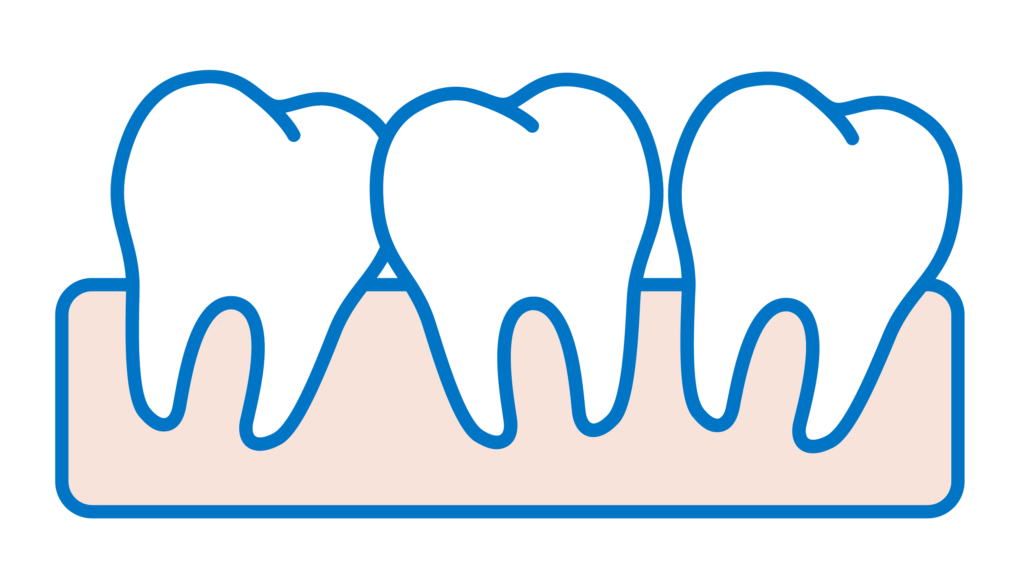 Faccette Dentali Posizione Denti