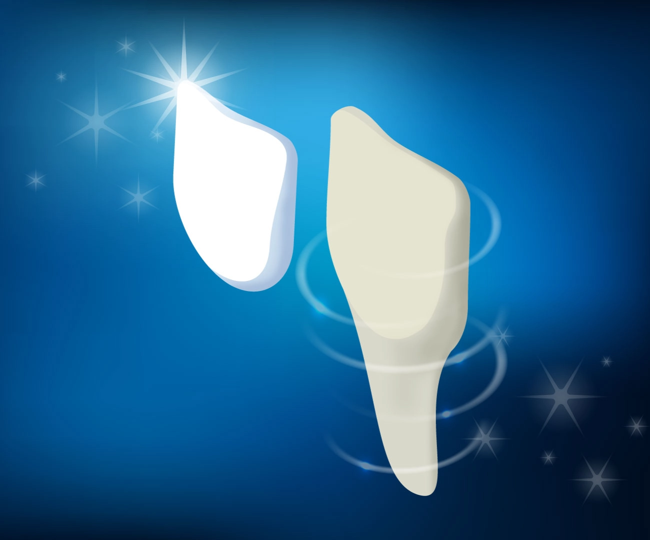 Protesi Faccette Dentali Dentista Prato My-Dentity