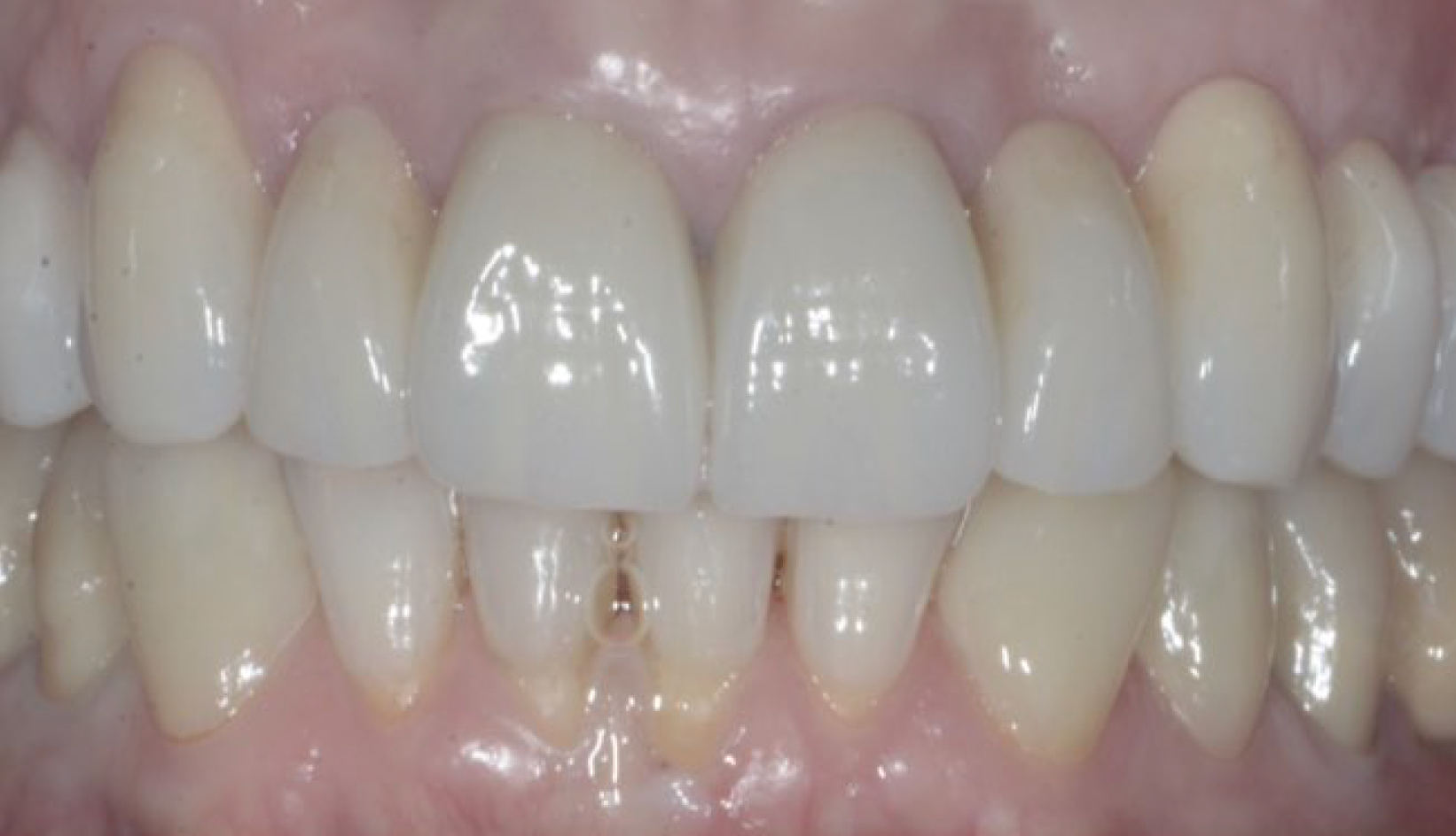 Protesi Additiva, Sbiancamento, Paradontologia Dentista Prato My-Dentity