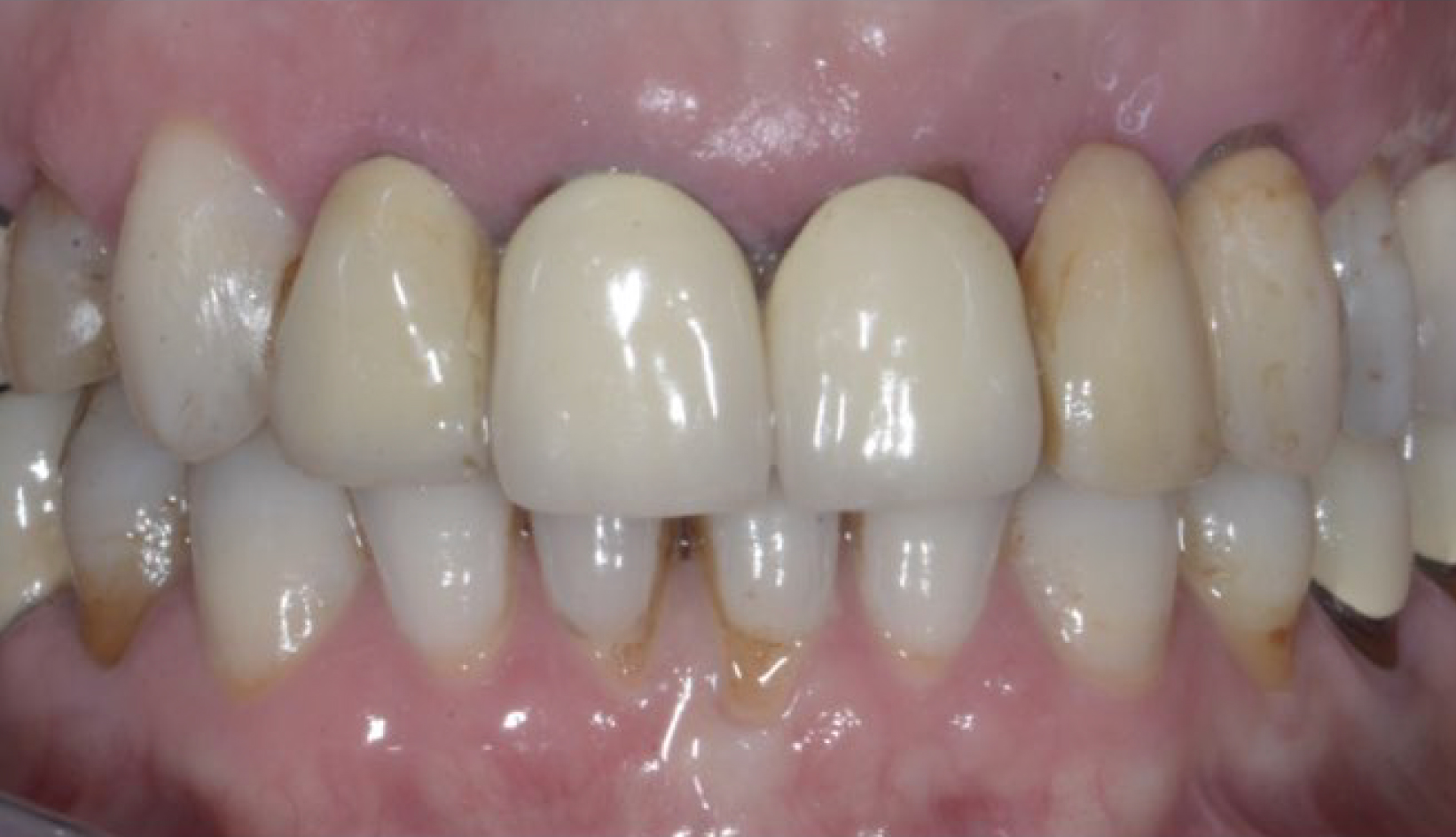 Protesi Additiva, Sbiancamento, Paradontologia Dentista Prato My-Dentity