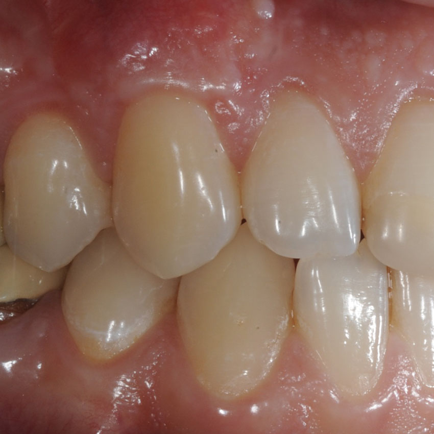 Chirurgia Muco Gengivale Dentista Prato My-Dentity