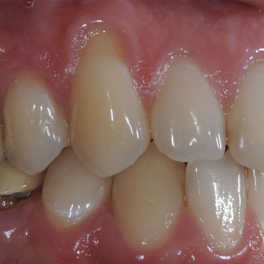 Chirurgia Muco Gengivale Dentista Prato My-Dentity