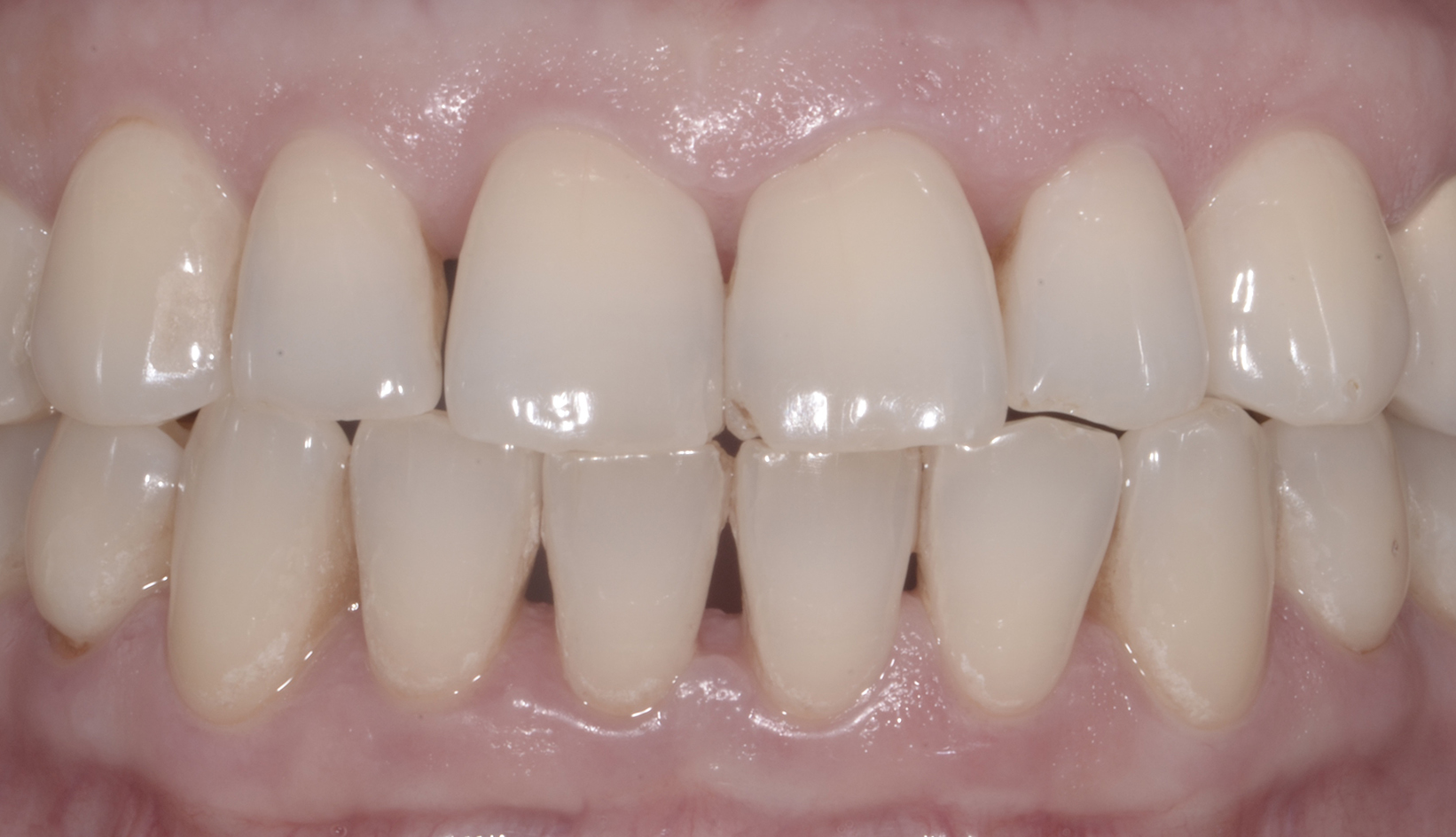 Igiene e Prevenzione Dentista Prato My-Dentity
